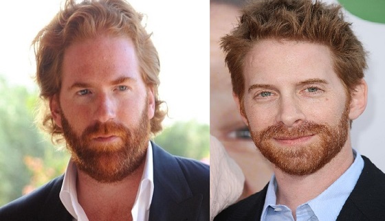 Who does Seth Green look like